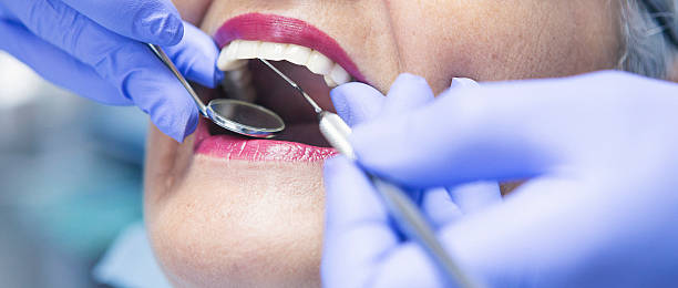 Best Emergency Dental Care for Broken or Chipped Teeth in Ashland City, TN